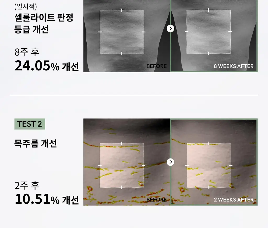 [탄력/목주름 개선] 힐그리즈 레티노이드 0.1% 퍼밍 바디 세럼 150ml 상세페이지 15